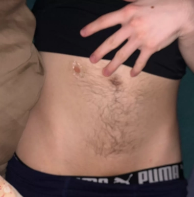 @ecaustics