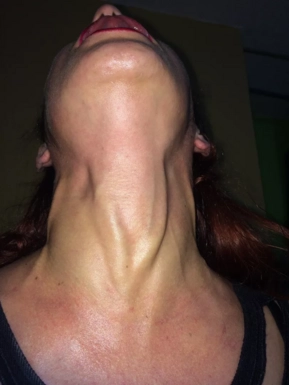 @janyneckveins
