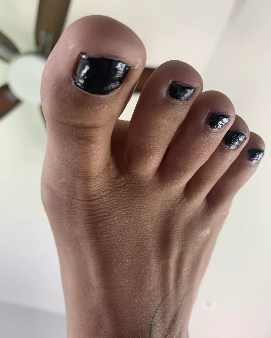 @fugly-feet